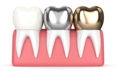 Discover the Future of Dental Crowns with Innovative Technologies That Will Transform Your Smile