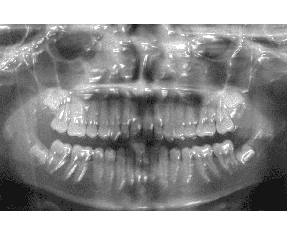 3d x-rays