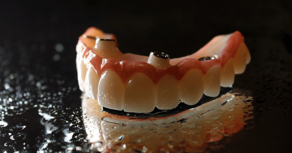 implant dentist Toms River