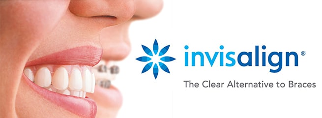 invisalign clear braces aligners toms river nj