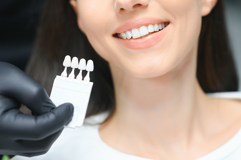 Dental veneers in Toms River
