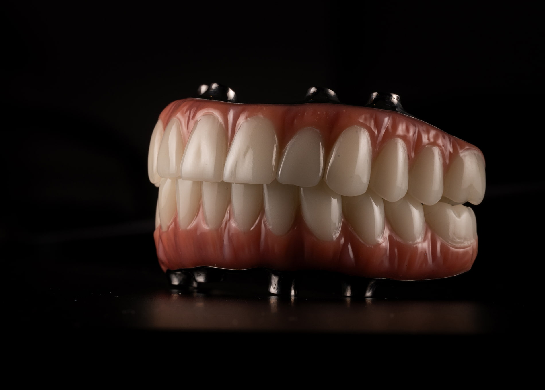 full mouth dental implants in Toms River