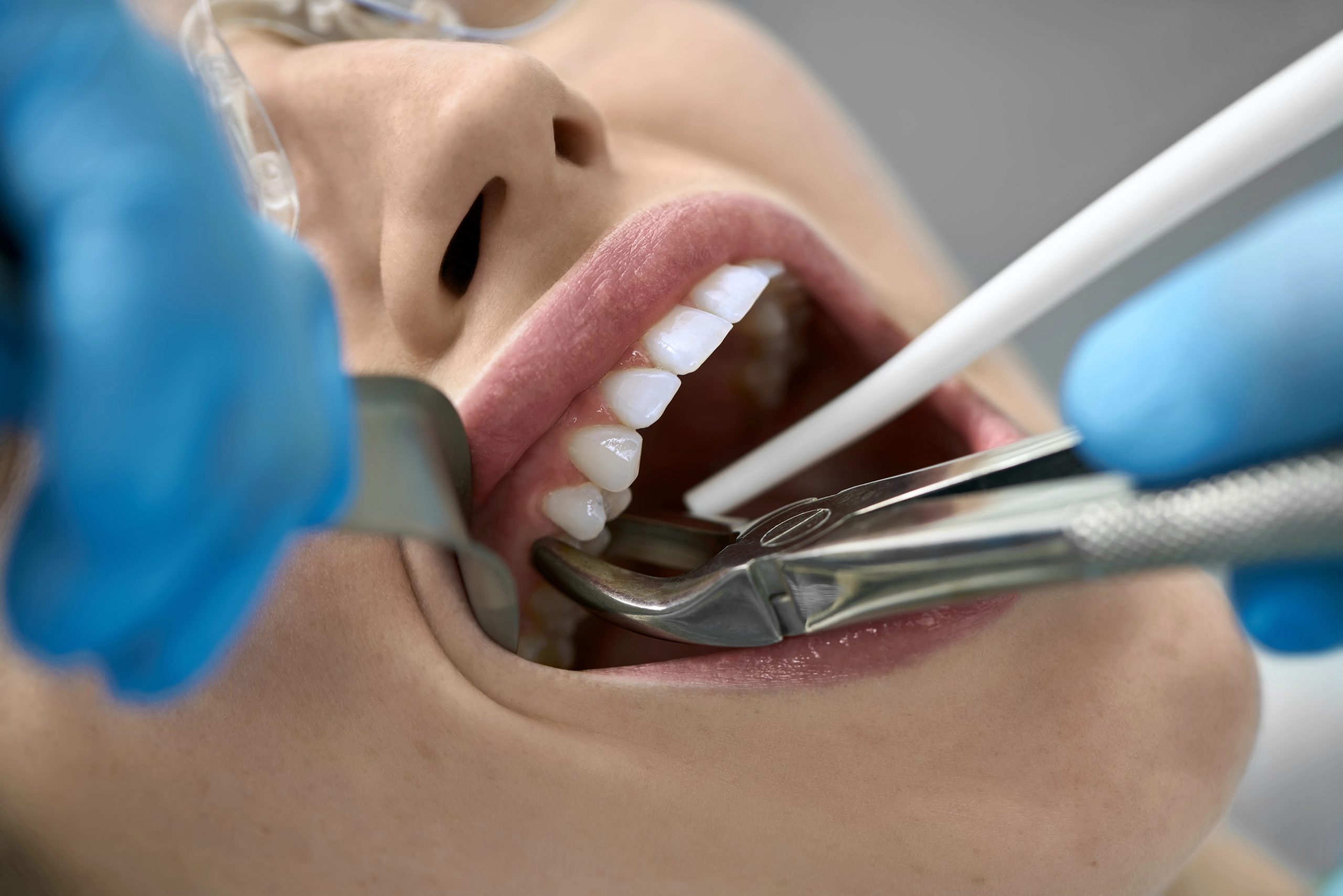 emergency dentist